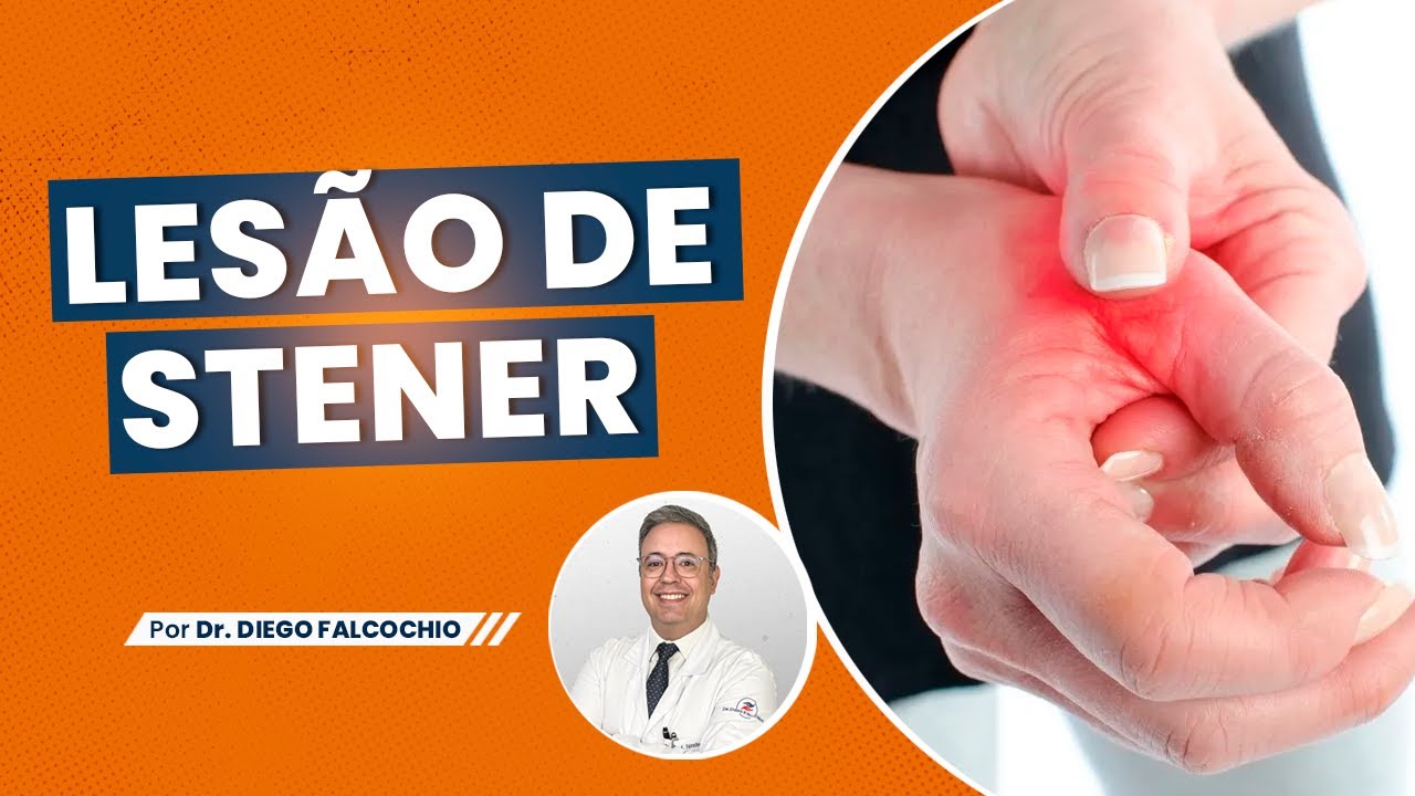 Lesão de Stener | O que é?