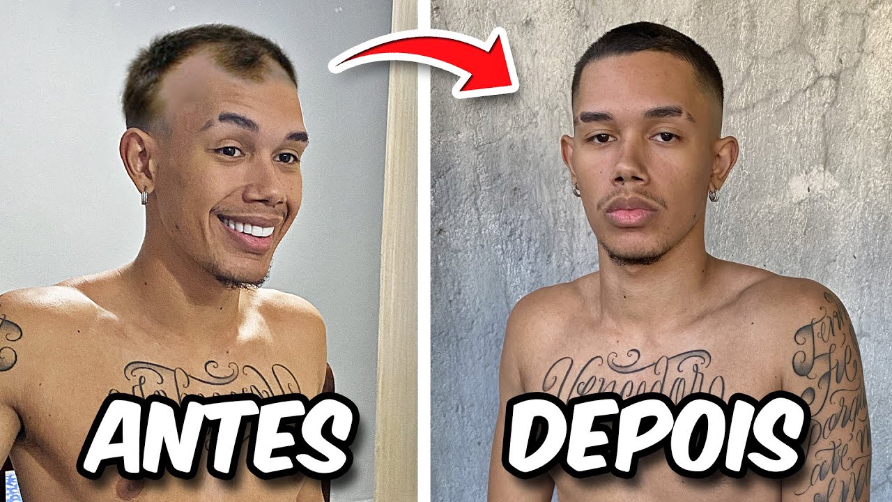 COMO DISFARÇAR A CALVICE