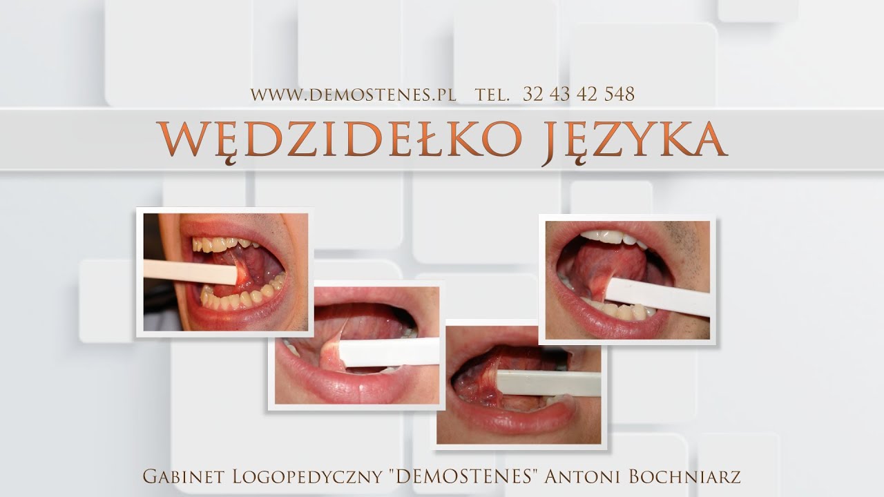 Wędzidełko