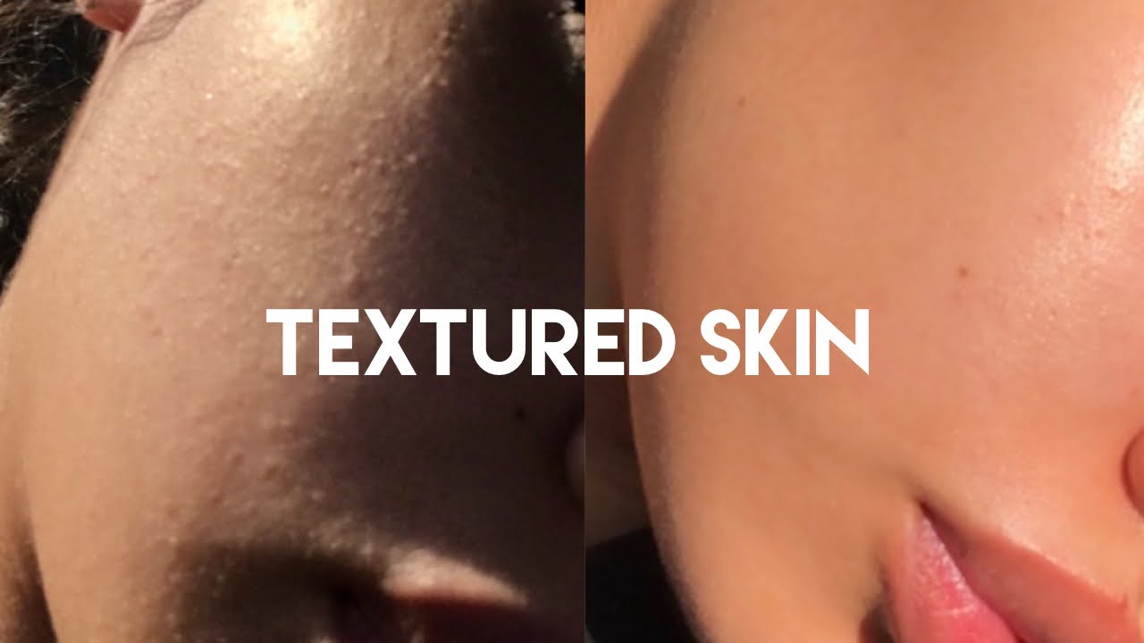 SKIN CARE ROUTINE | HOW I GOT RID OF TEXTURE IRREGULARITIES