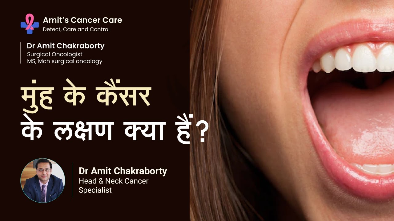 मुंह के कैंसर के लक्षण क्या हैं? | What are the Symptoms of Mouth Cancer? |  Dr Amit Chakraborty