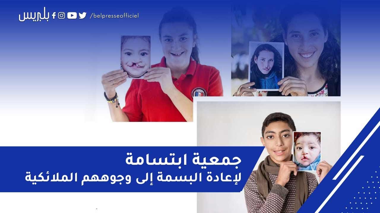 جمعية ابتسامة تتكلف بالأطفال المشوهين خلقيا وتعيد لهم 