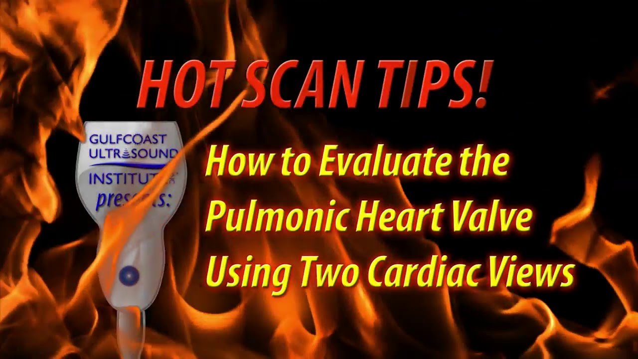 Hot Tip - How to Evaluate the Pulmonic Heart Valve Using Two Cardiac Views