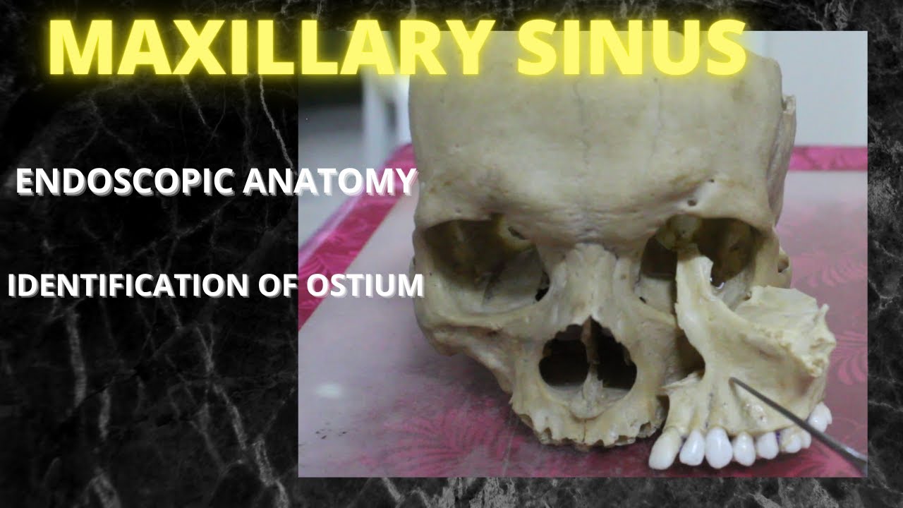 045. Anatomy Maxillary Sinus.  #anatomylectures