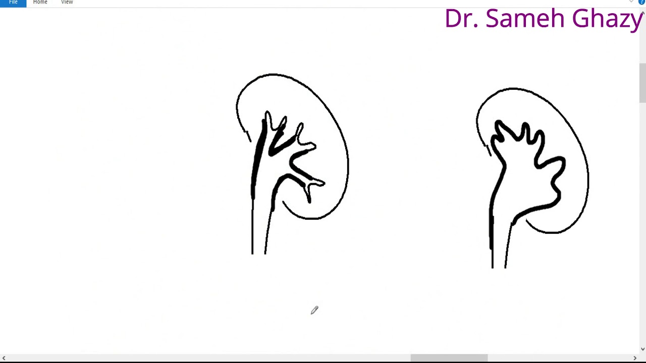 systemic pathology 52 : Urinary system 6  ( obstructive uropathy ) DR. SAMEH GHAZY