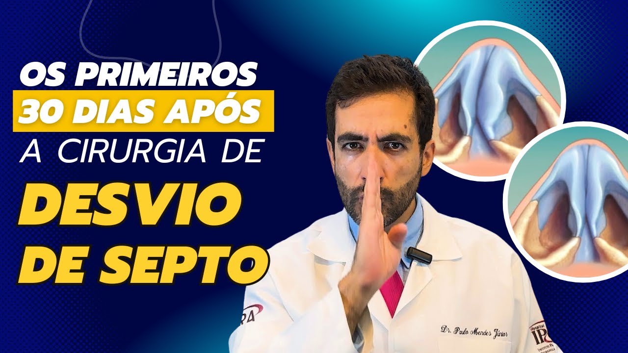 30 dias após cirurgia do septo nasal: O que você PRECISA saber