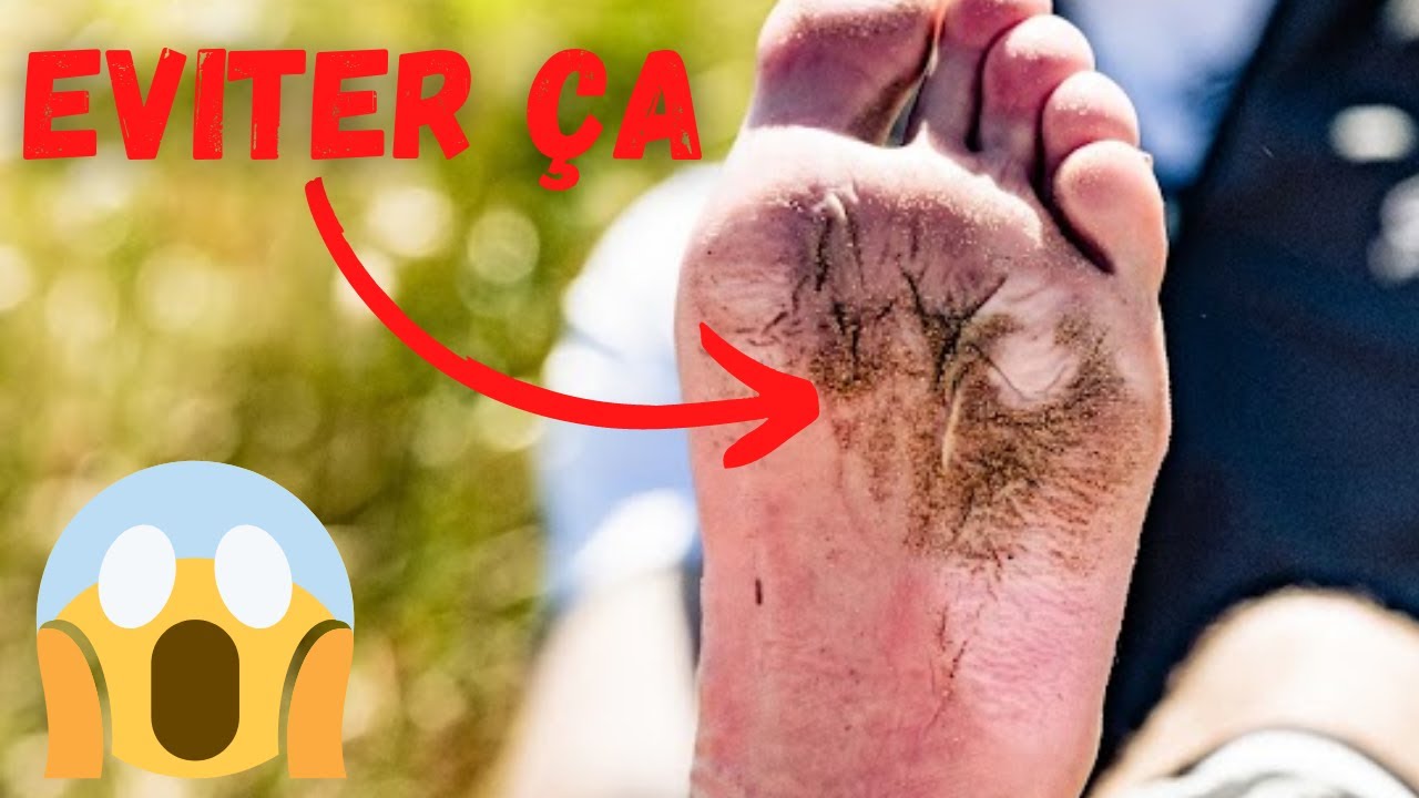 Comment prendre soin de ses pieds en Trail ?