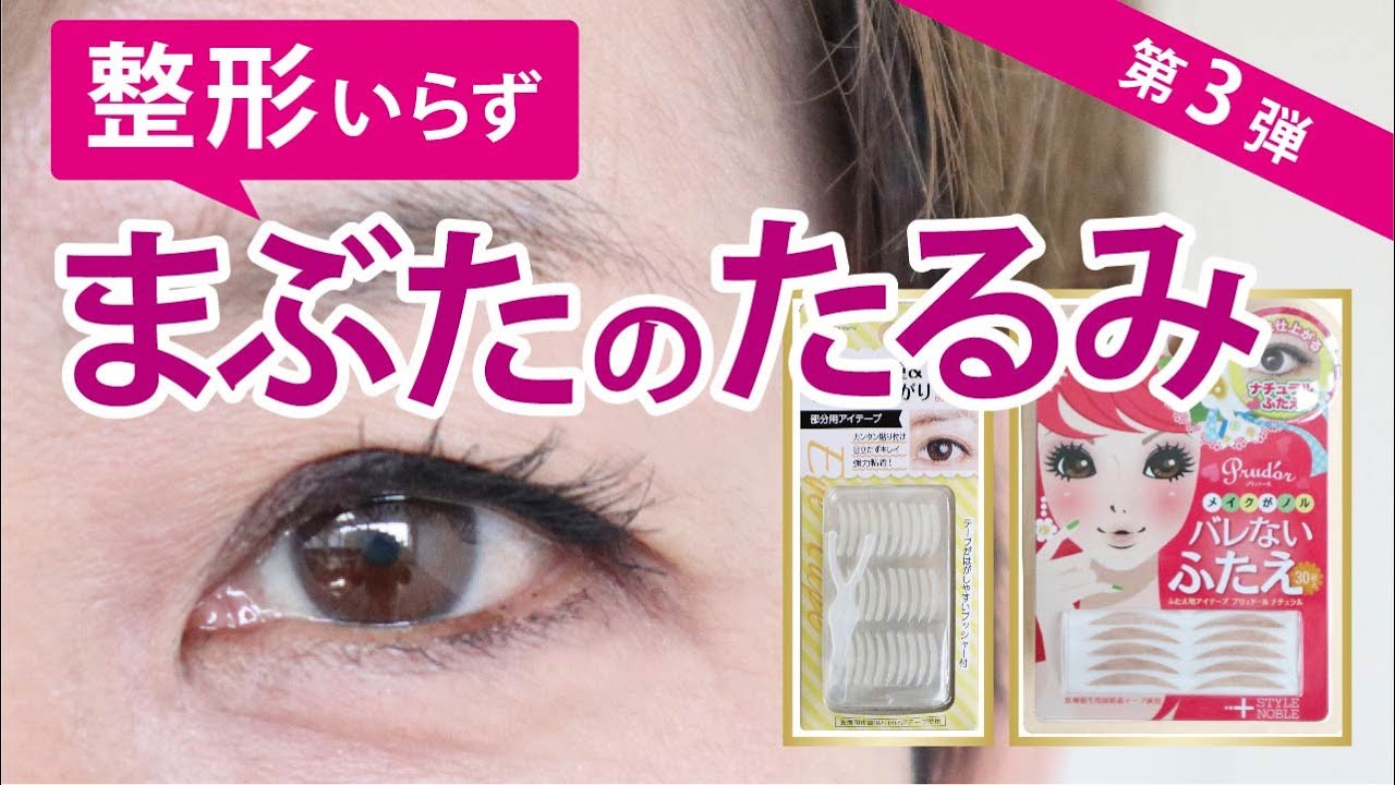 【整形いらず】アイテープの徹底比較！第３弾