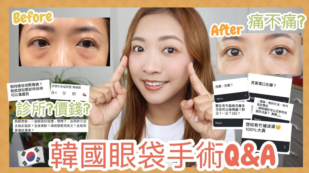 ♥ BYEBYE眼袋#2 ♥ 眼底脂肪重置手術Q&A💬究竟是怎樣的價錢令我衝去韓國動手術？🤑動刀為什麼沒傷口？❤️‍🩹診所醫生資料超～～詳細分享📝 || Dottie Hidee ||