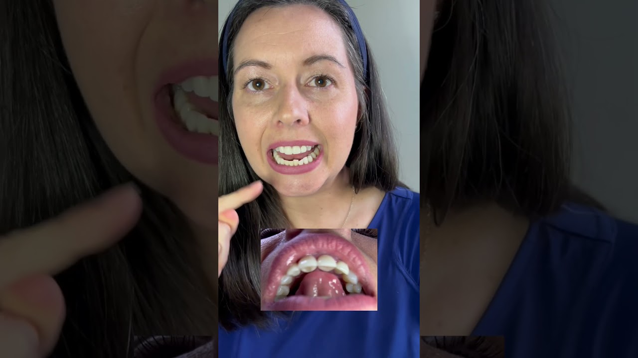 How to make /t/ #speechtherapy #funlearningathome #speechpractice #speechsounds #slp #speechmastery