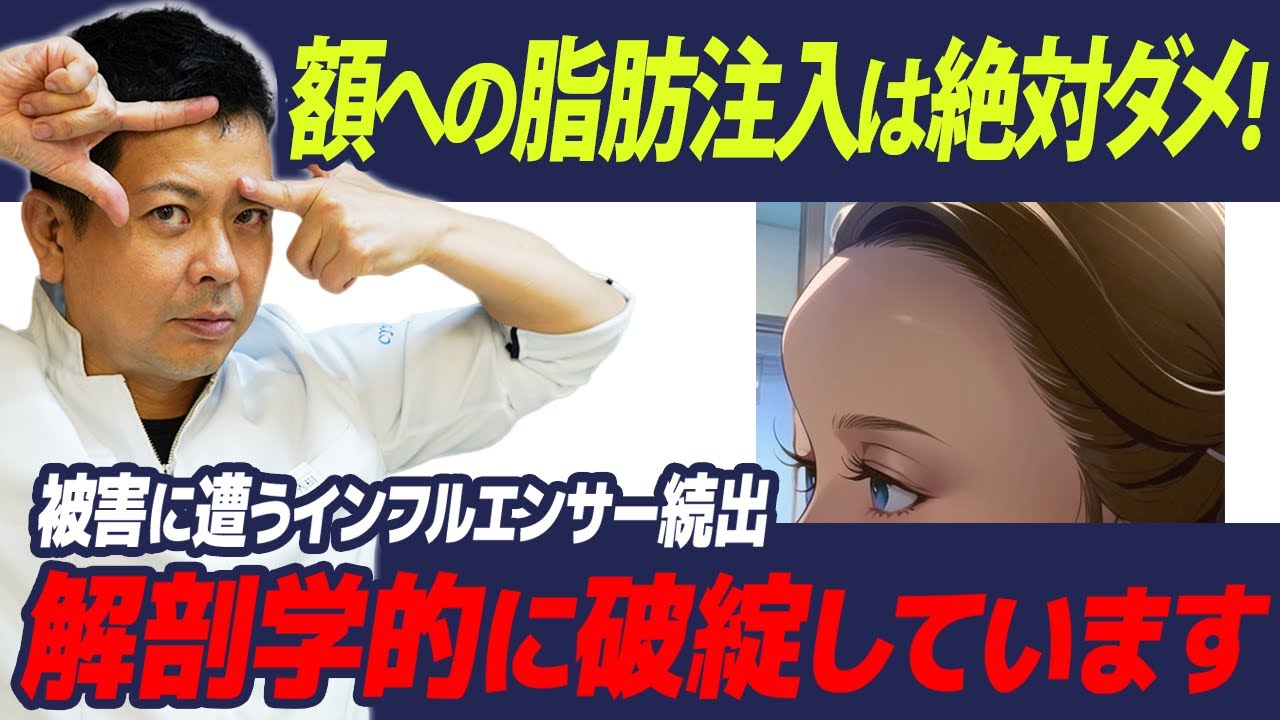 有名インフルエンサーも失敗！額への脂肪注入は治らない凹凸リスクあり
