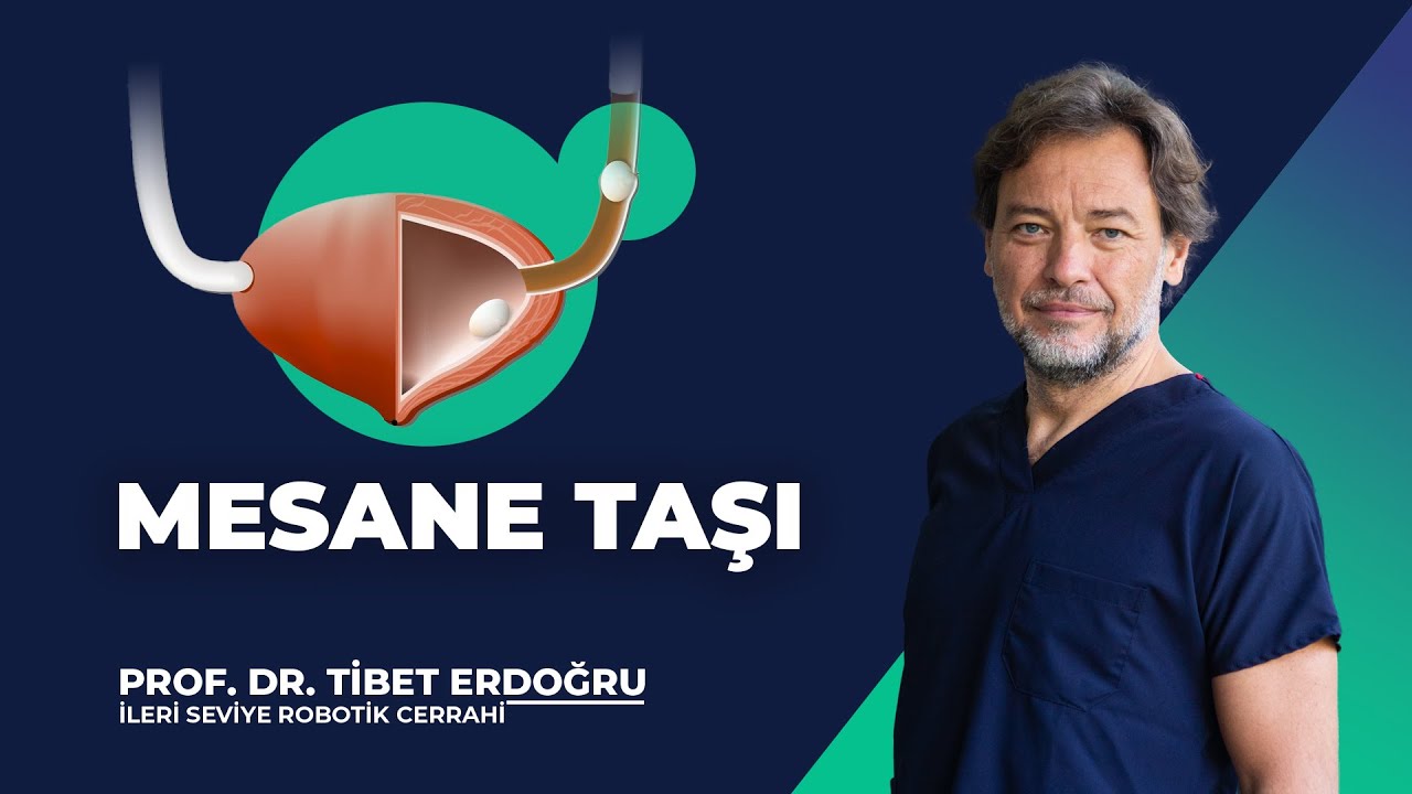 Mesane Taşı - Prof. Dr. Tibet Erdoğru