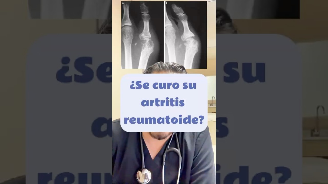 🤚 Su artritis reumatoide no solo se detuvo&hellip; &iexcl;los huesos sanaron!