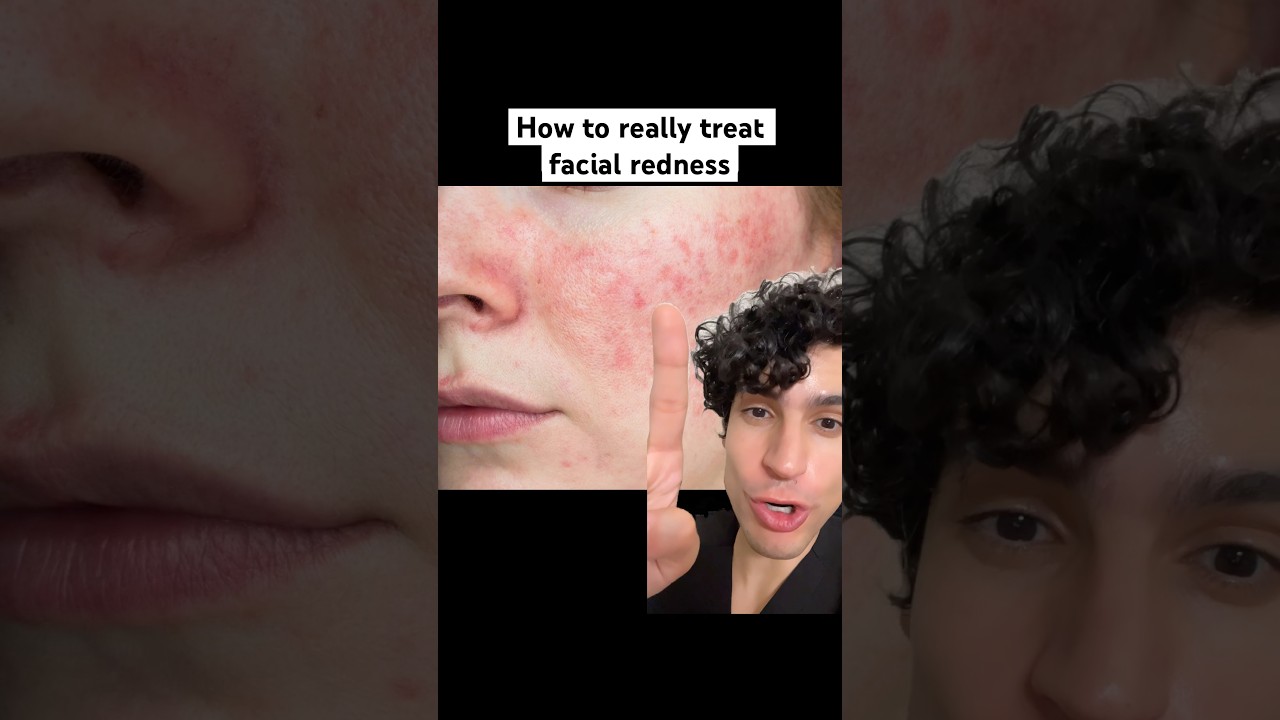 Derm explains how to really cover facial redness #redness #redface #rosacea #rosaceatreatment