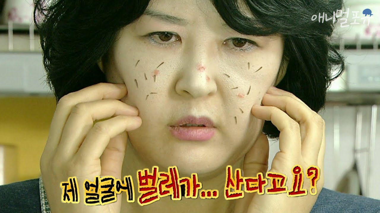 피부 속에 벌레가 산다?! 거의 모든 사람에게 존재하는 피지를 먹고 사는 벌레, 모낭충 😲｜KBS 위기탈출 넘버원 111212 방송