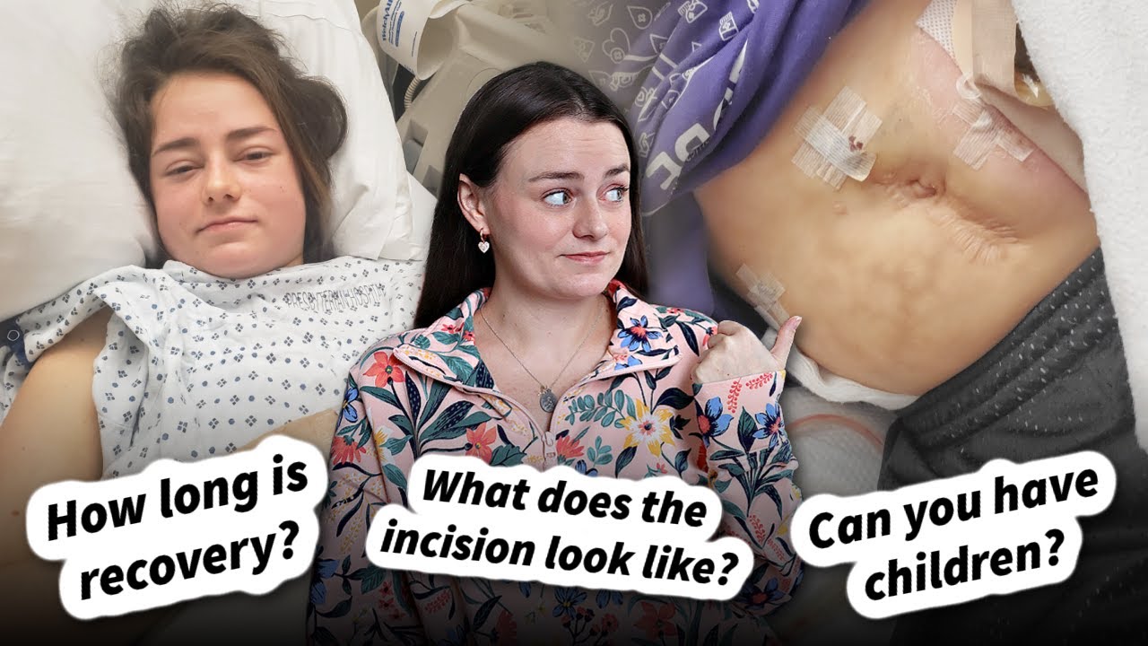Rectum Removal & The Most Common Questions About This Surgery | Let's Talk IBD