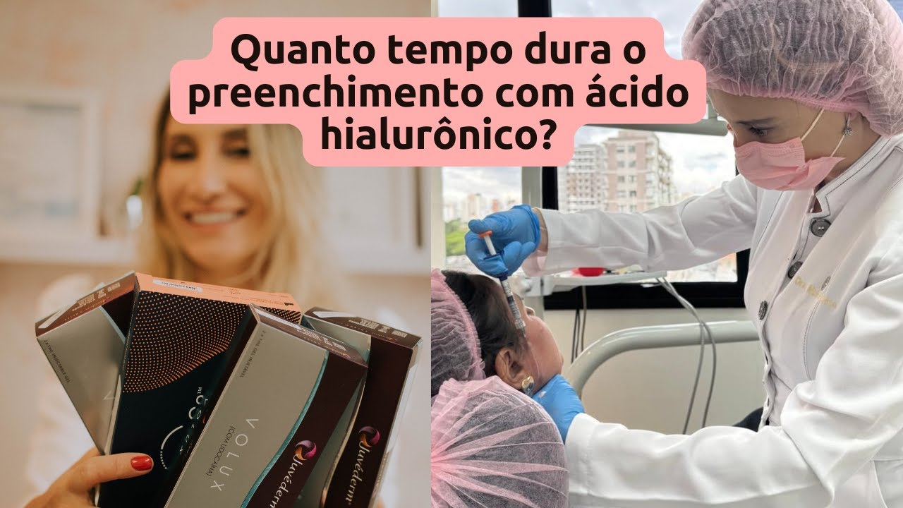 Quanto tempo dura o preenchimento facial com  ácido hialurônico?