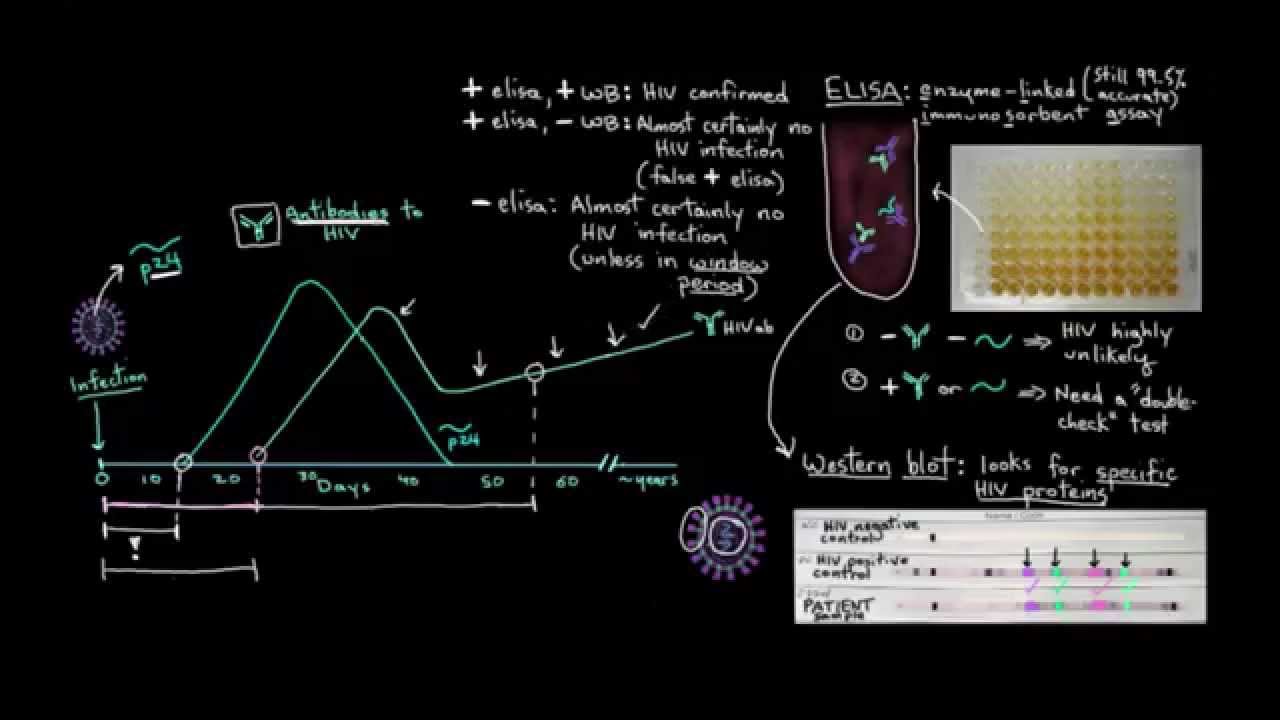 Khan Academy - Diagnosing HIV: Concepts and Tests
