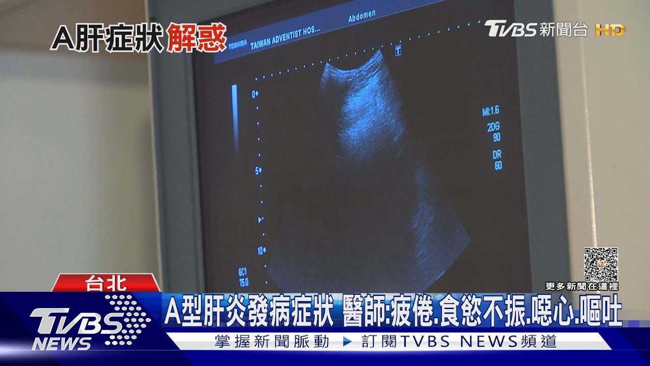 注意!出現「這幾種」症狀 恐罹A型肝炎 醫師:速就醫檢查....｜十點不一樣20230512@TVBSNEWS02