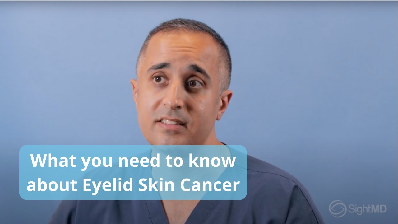 Eyelid Skin Cancer Treatment with Dr. Baharestani - SightMD New York