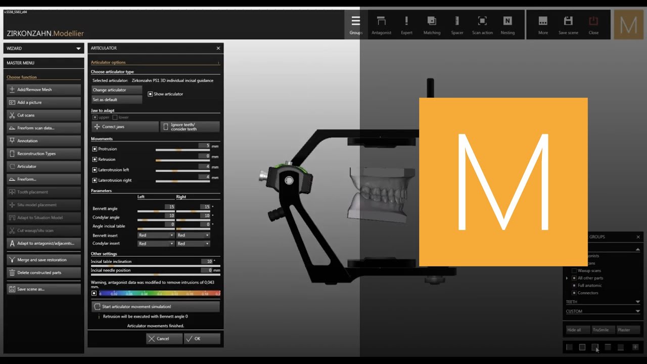 Virtual Articulator software module of Zirkonzahn.Modellier | Zirkonzahn.Software