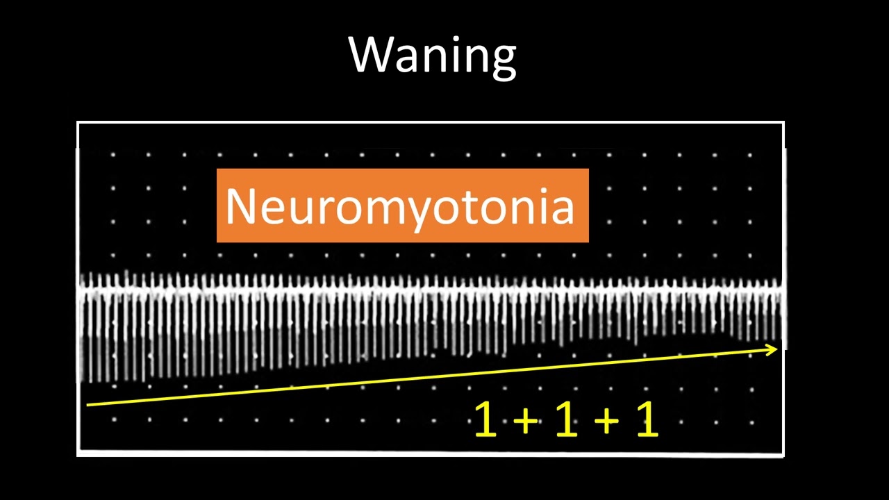 EMG question of the day 5