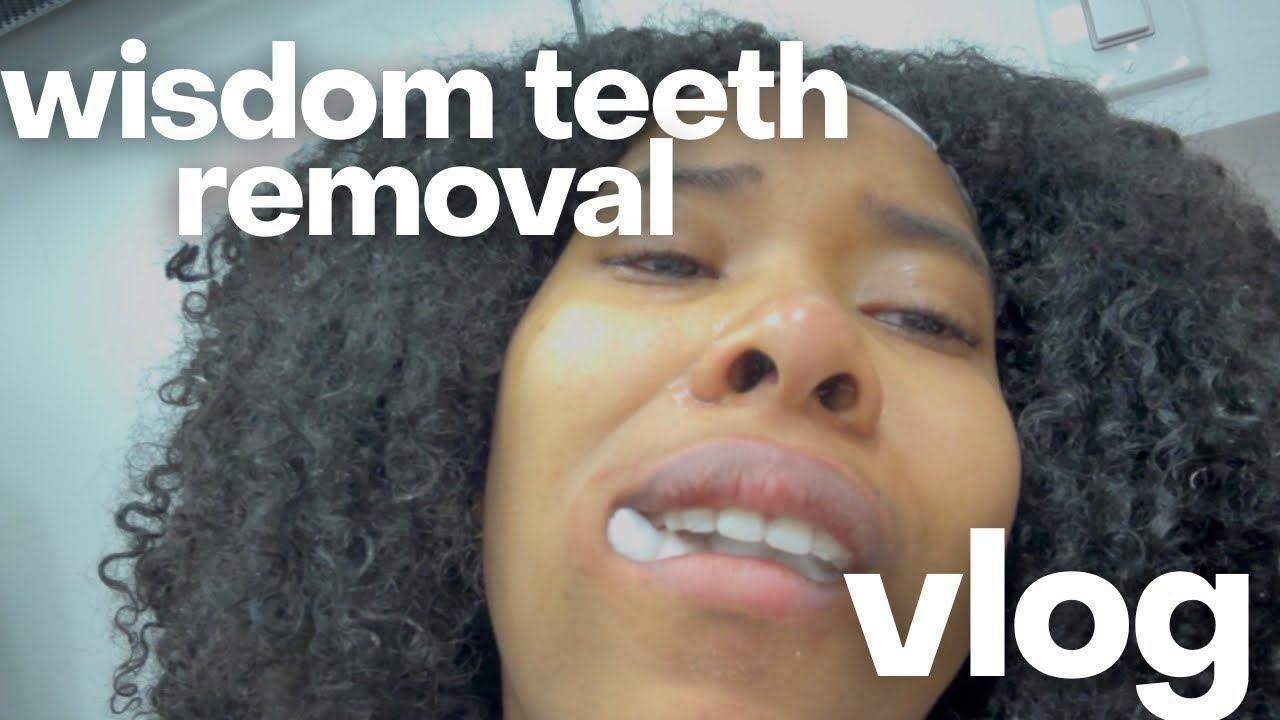 20s Diaries: I Was NOT Ready for This… (Wisdom Teeth Removal) 