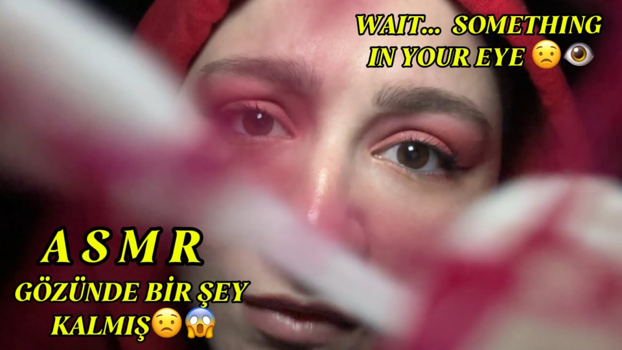 ASMR Roleplay | Gözünde Bir Şey Kalmış 😟👁️ | Something Is In Your Eye 👀🕸️