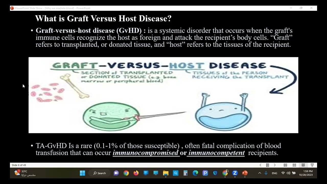 2- Irradiation : Why do we irradiate Blood ? GvHD History and Pathogenesis.