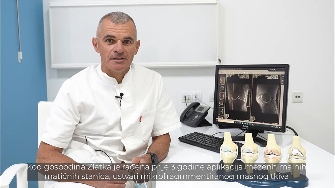 Iskustvo pacijenta - Aplikacija mezenhimalnih matičnih stanica iz masnog tkiva