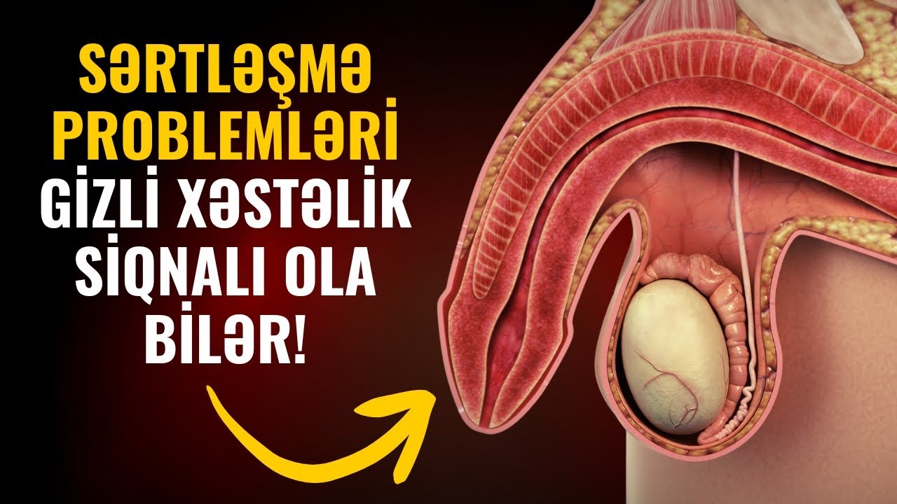 Sərtləşmə başlayır, amma yarımçıq qalırsa – səbəb nədir?