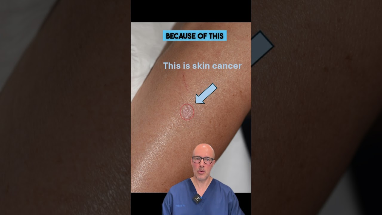Does Skin Cancer Itch? | Early Signs You Shouldn&rsquo;t Ignore