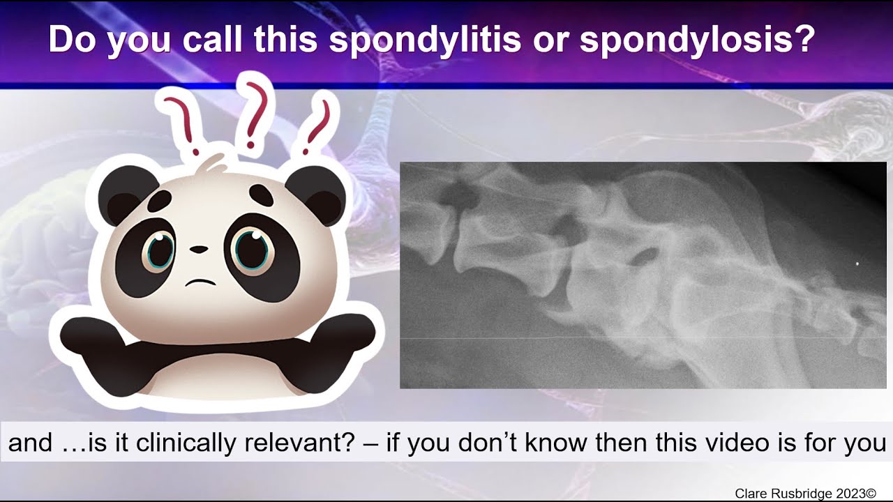 Bony spurs between the vertebrae? - is is spondylosis, spondylitis, discospondylitis or DISH?