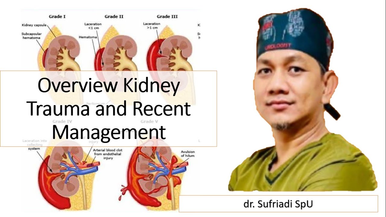 Overview Kidney Trauma and Recent Treatment - dr. Sufriadi, SpU