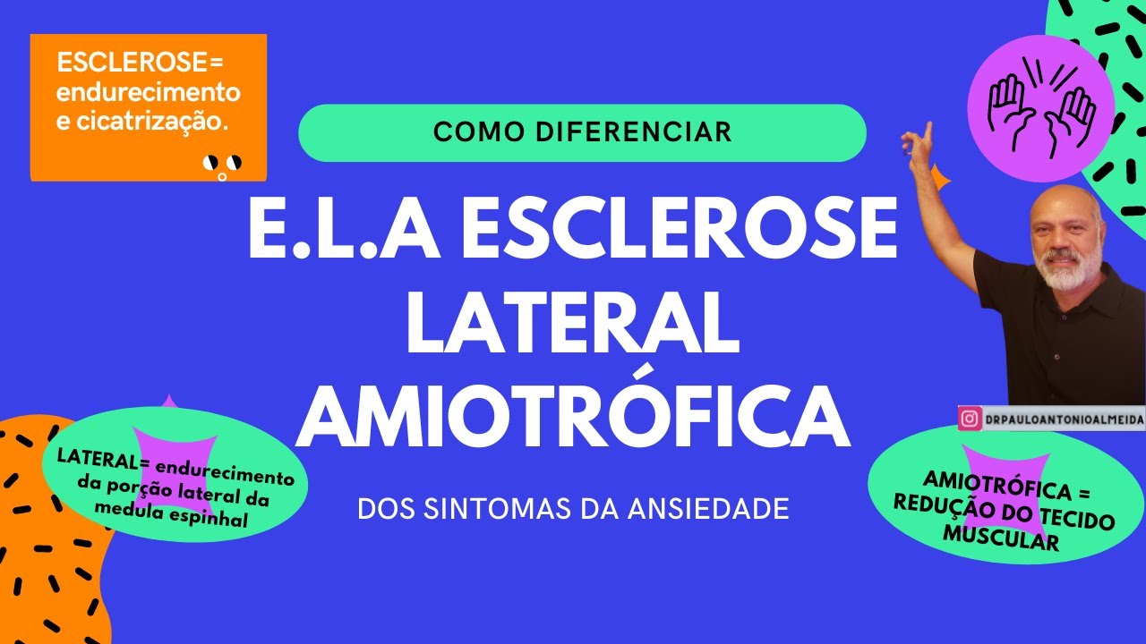 COMO DIFERENCIAR O DIAGN&Oacute;STICO DE E.L.A, ESCLEROSE LATERAL AMIOTR&Oacute;FICA DOS SINTOMAS DA ANSIEDADE