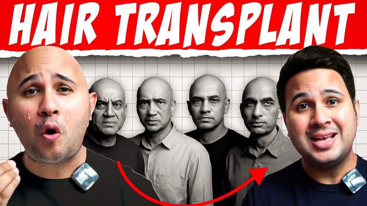 Hair Transplant Is Dangerous? 
