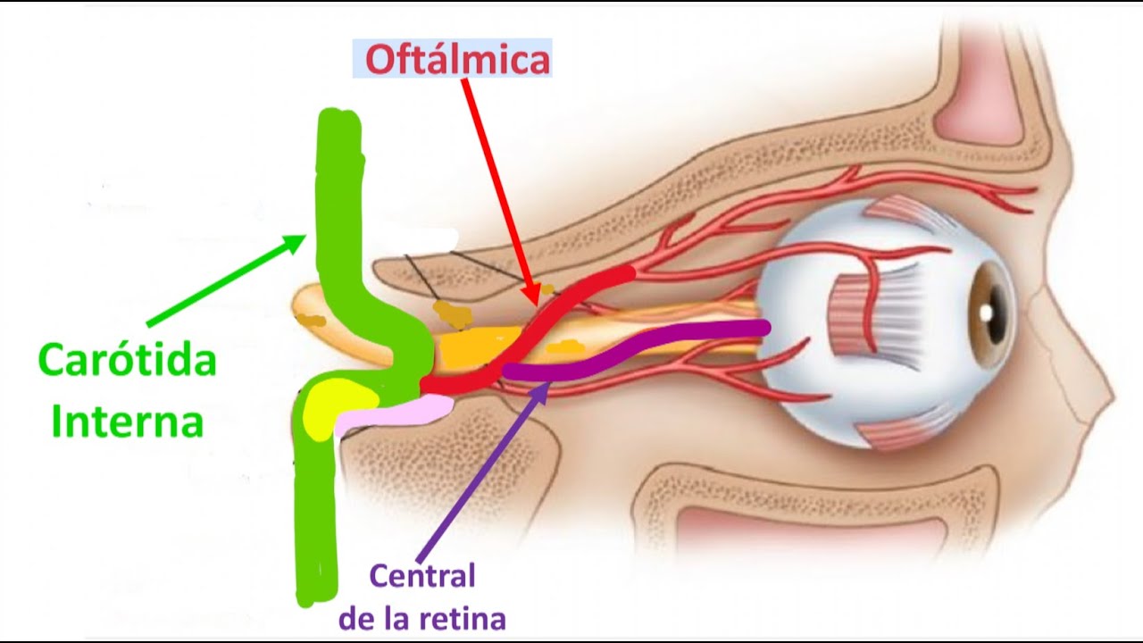 Síndrome Ocular Isquémico
