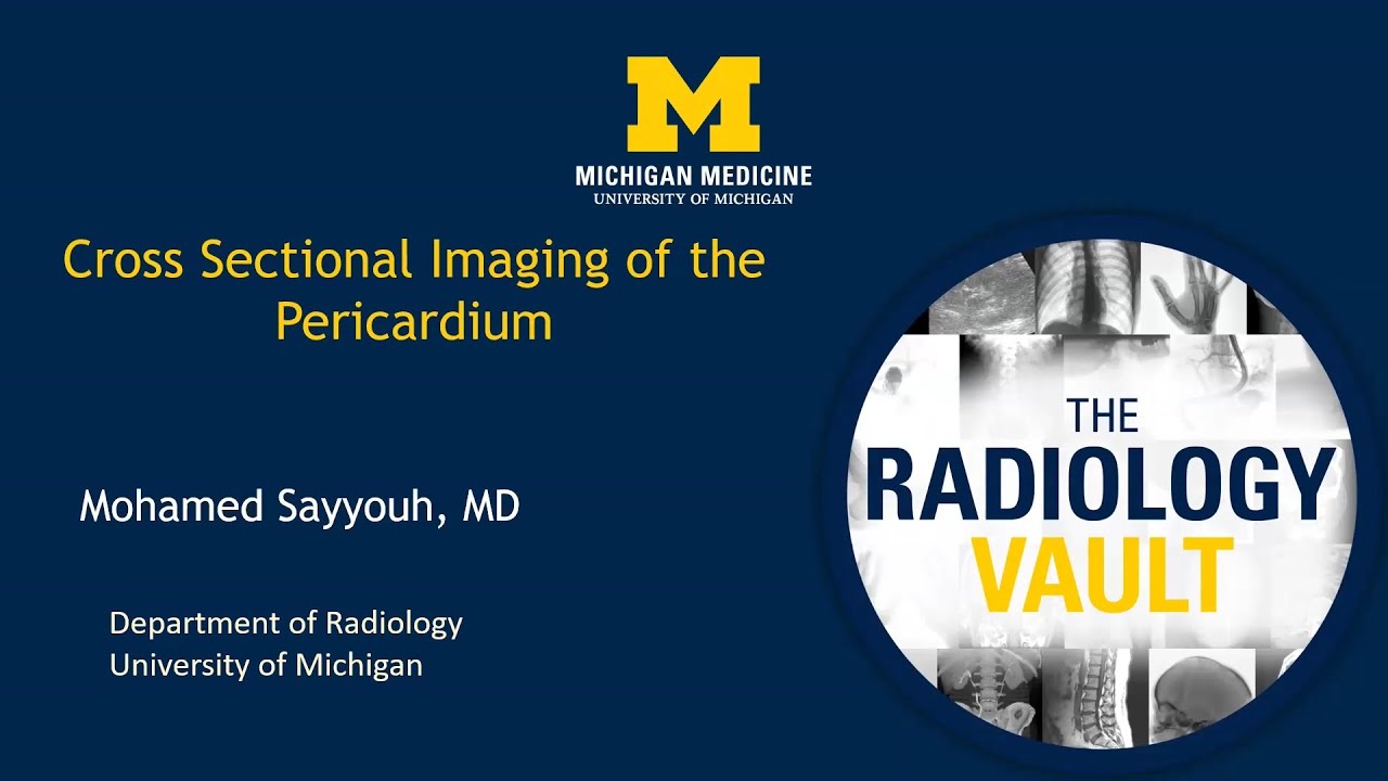 Cross Sectional Imaging of the Pericardium