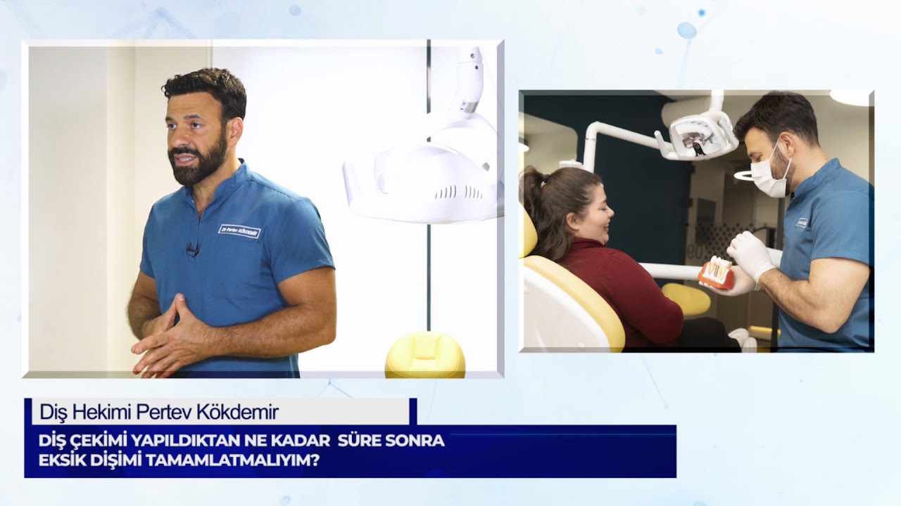 Diş Çekimi Yapıldıktan Ne Kadar Süre Sonra Dişimi Tamamlatmalıyım ? Sizden Gelen Sorular