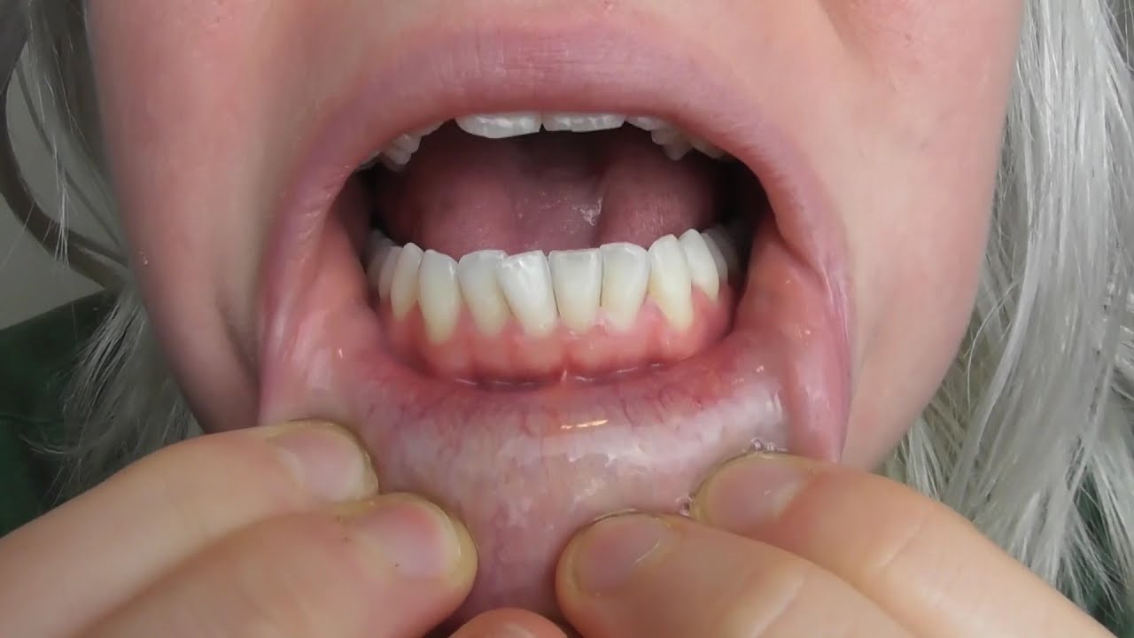 Mouth tour and uvula close up