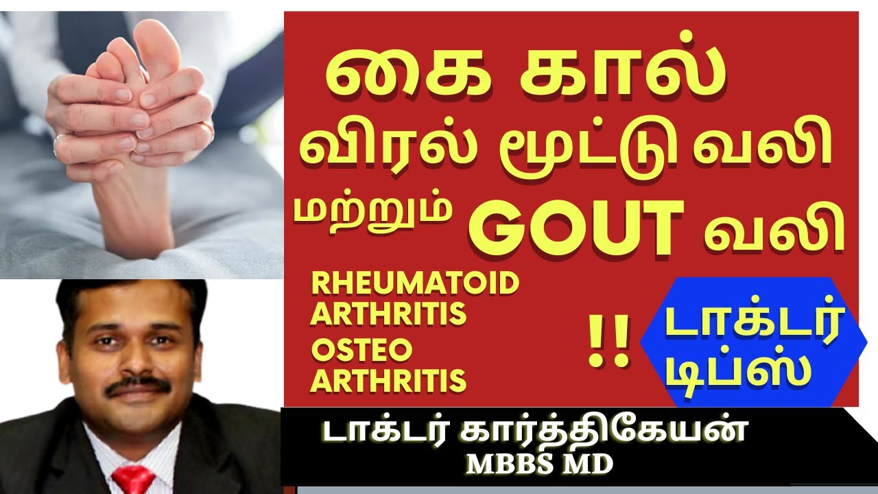 gout rheumatoid arthritis osteoarthritis treatment / கவுட் சரவாங்கி மூட்டு வலி மருத்துவம்