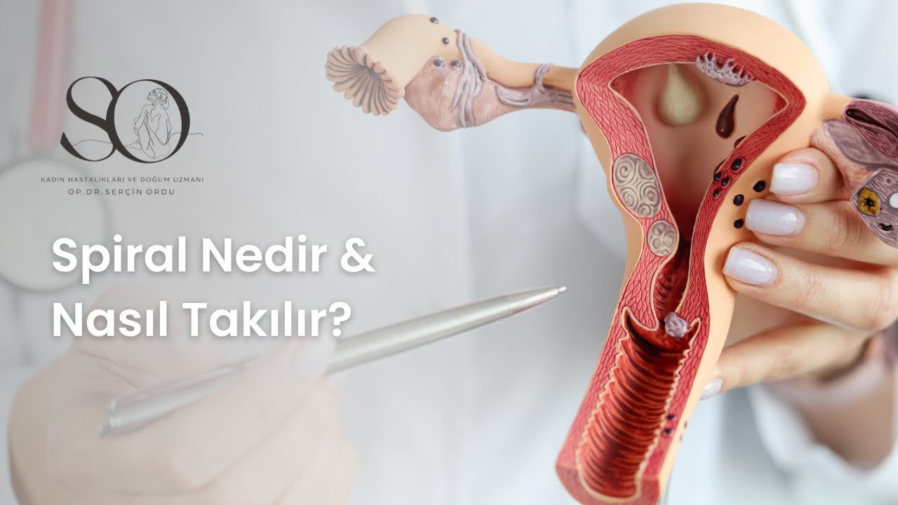 Spiral Nasıl Takılır? Spiral Gebeliği Yüzde Yüz Engeller Mi?