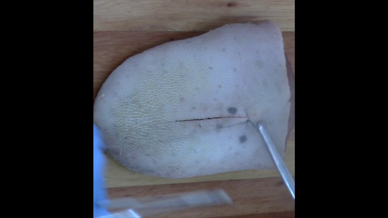 Sutura Contínua Ancorada 2020