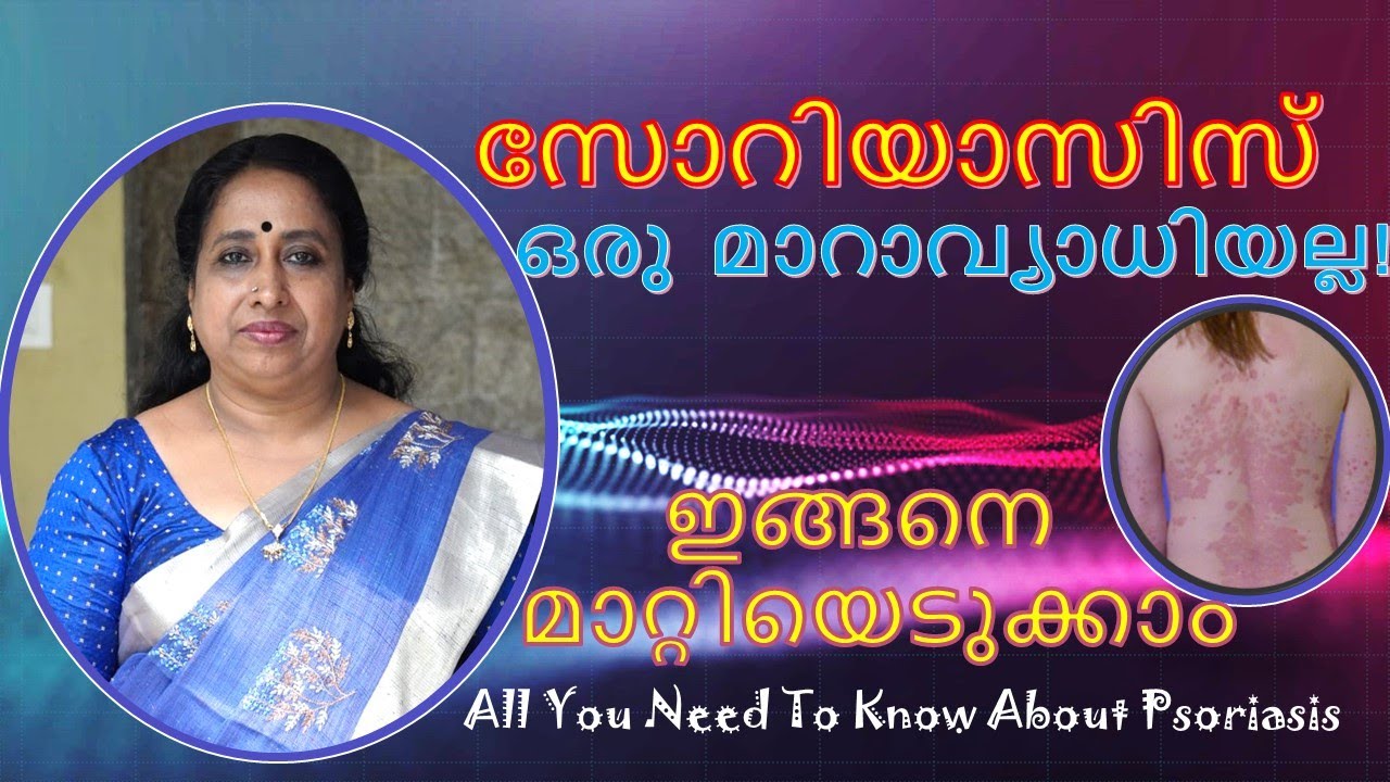 സോറിയാസിസ് (Psoriasis) ഒരു മാറാവ്യാധിയല്ല, ഇങ്ങനെ മാറ്റിയെടുക്കാം  #psoriasis #psoriasisawareness