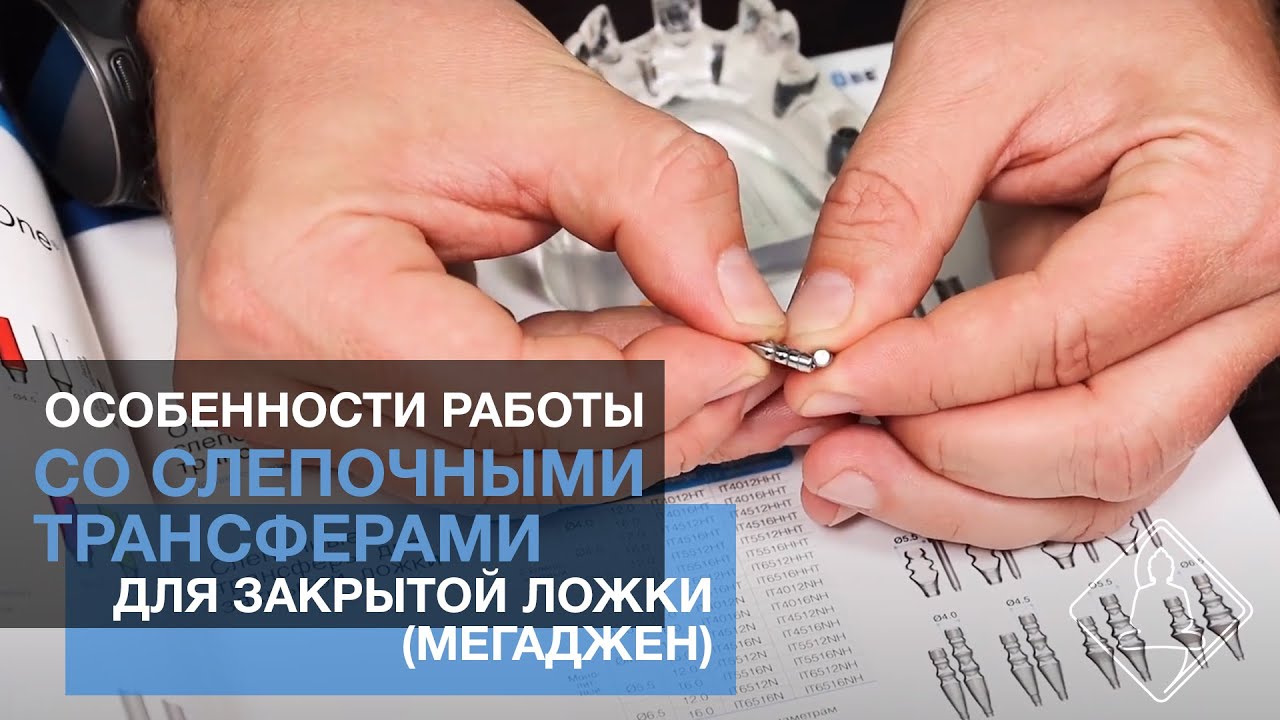 Особенности работы со слепочными трансферами для закрытой ложки (Мегаджен)