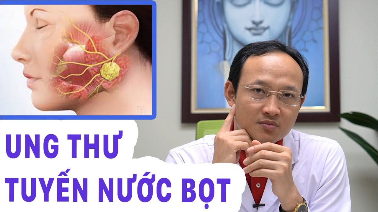 Ung thư tuyến nước bọt - Đặc biệt lưu ý ở nam giới | Tâm sự bác sĩ Khánh
