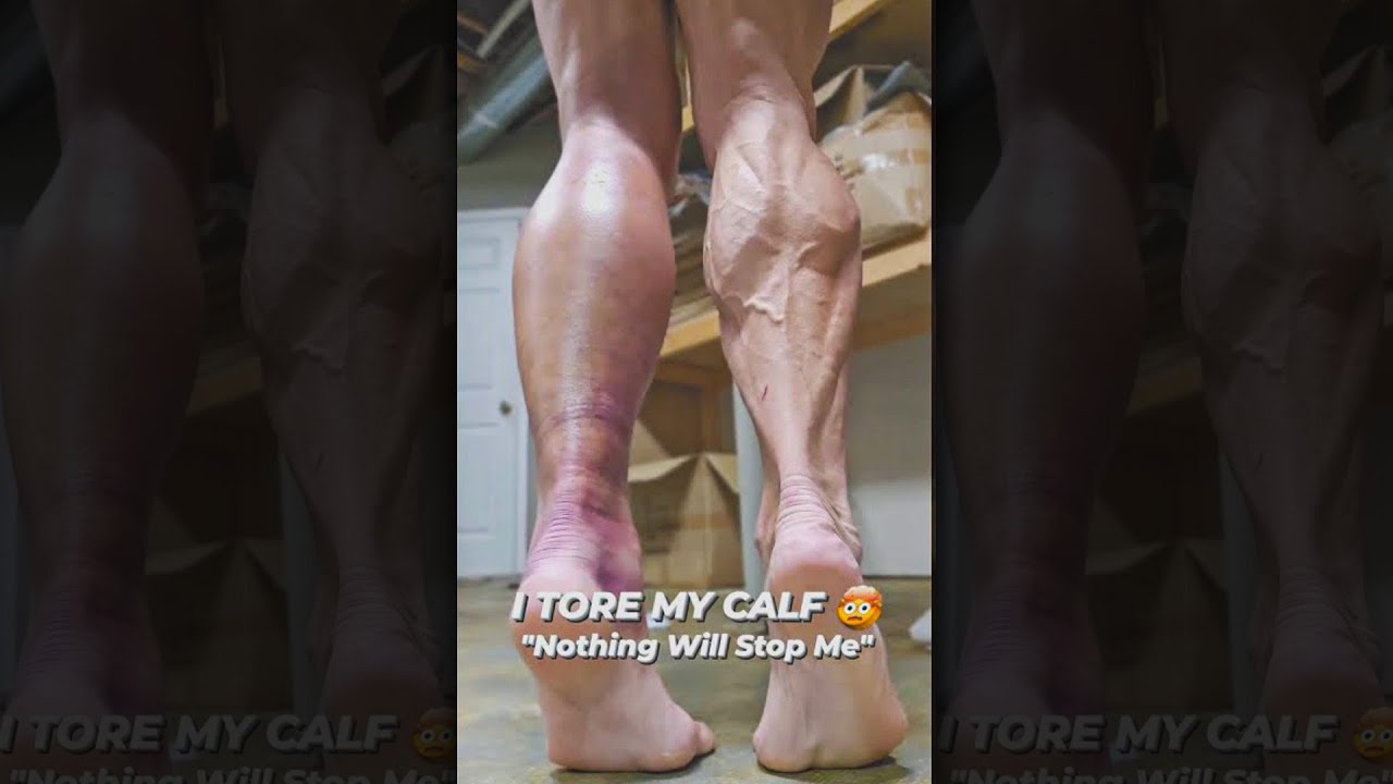 Bro Skipped Left Leg Day🤦‍♂️