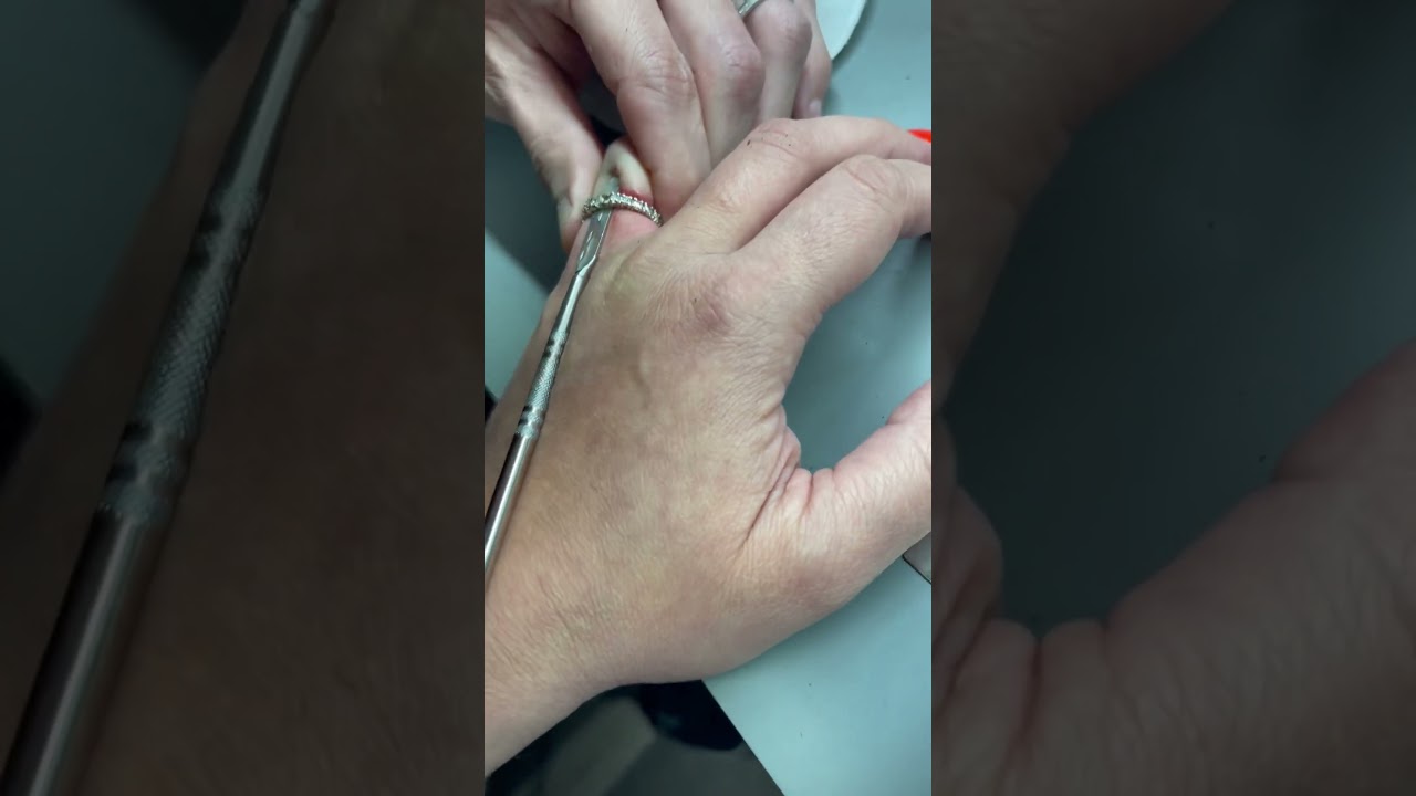 Sawing off my wife&rsquo;s old wedding ring that she forced on her finger. #platinum #diamond #ring