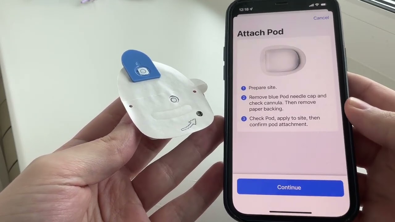 Omnipod Dash - обзор, установка на iPhone 12(iOS 15), FreeAPS X (openaps)