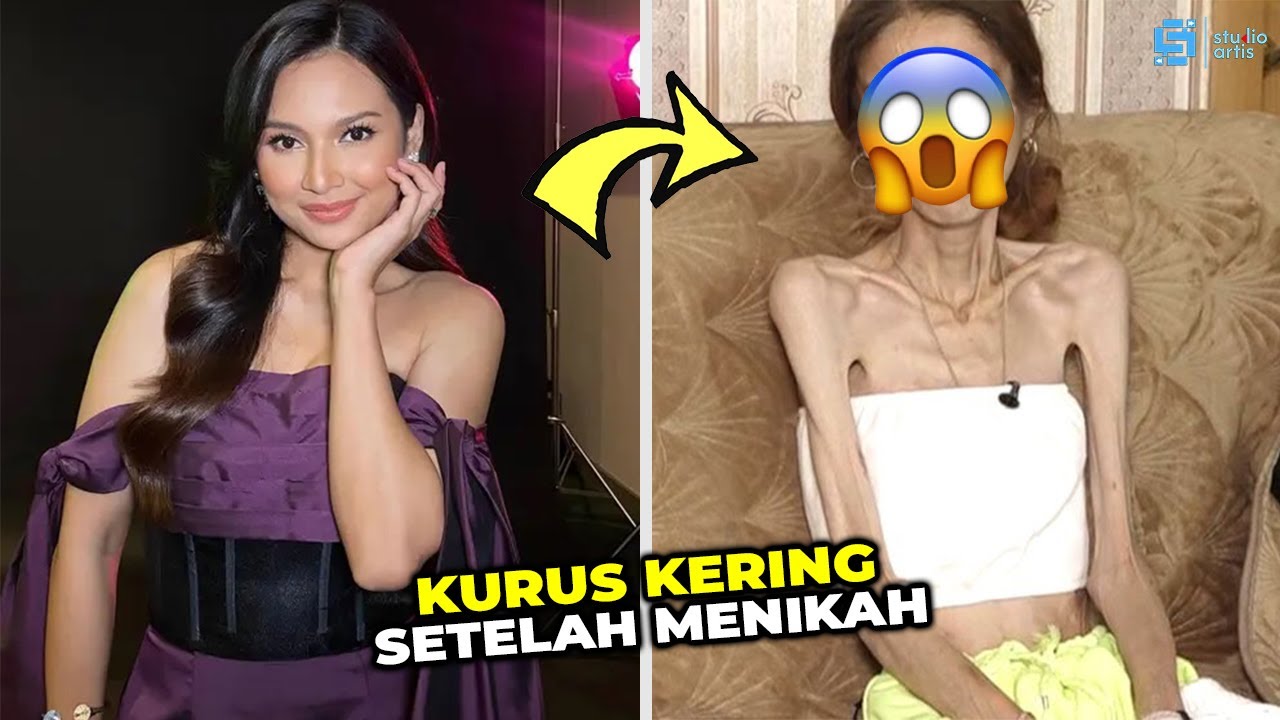 PANTAS JARANG TERSEROT !!! Tubuh 7 Artis Indonesia Berubah Drastis Setelah menikah